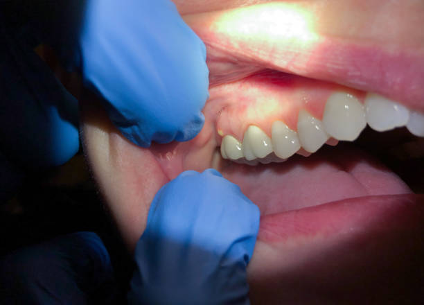 Best Dentist for Severe Toothache  in Westwego, LA